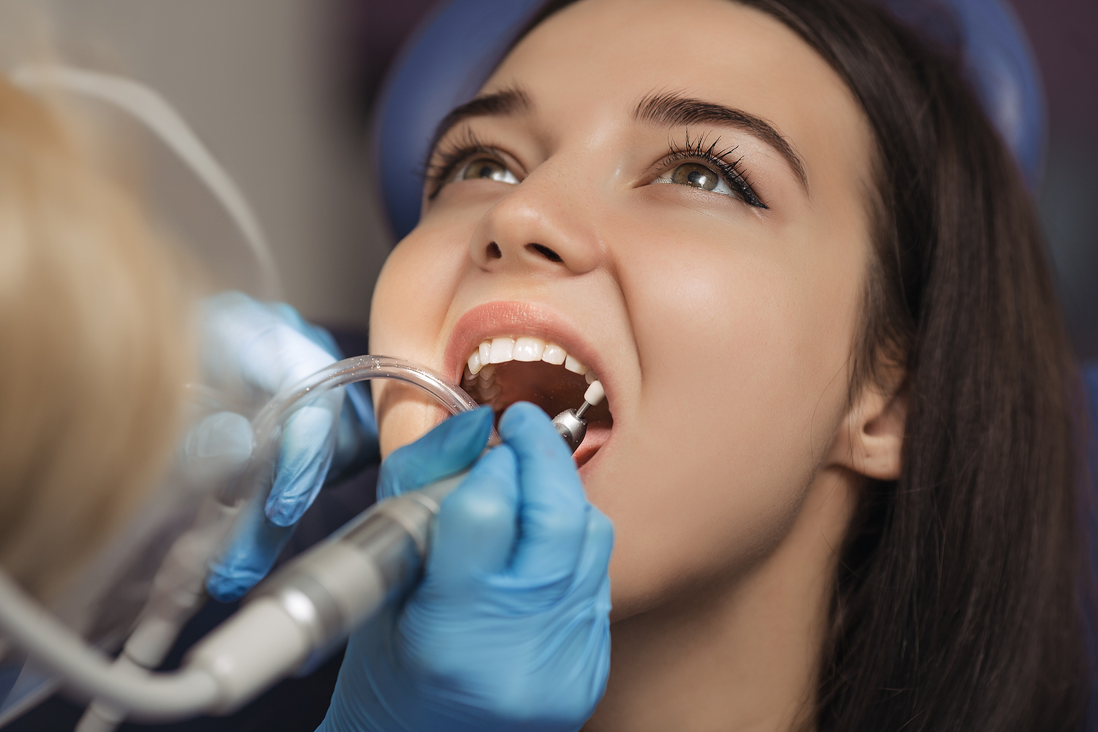Post-Operative Care for Dental Implants: Dos and Don’ts