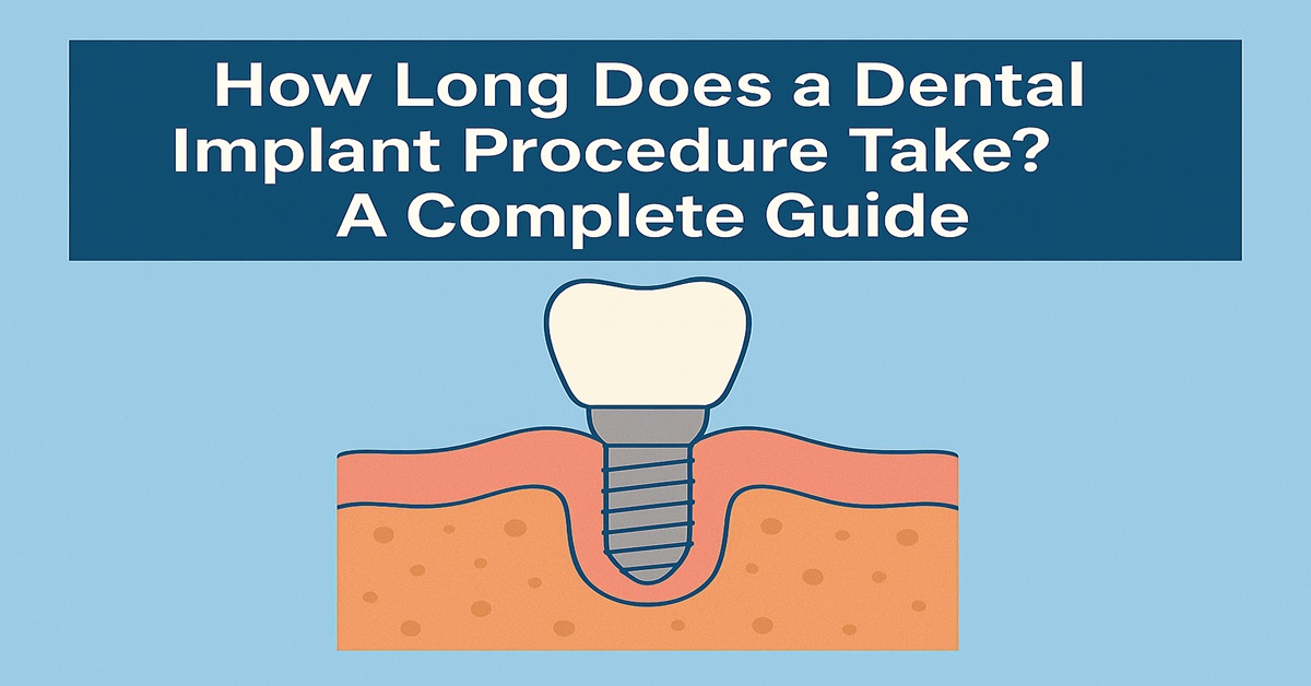 How Long Does a Dental Implant Procedure Take? A Complete Guide