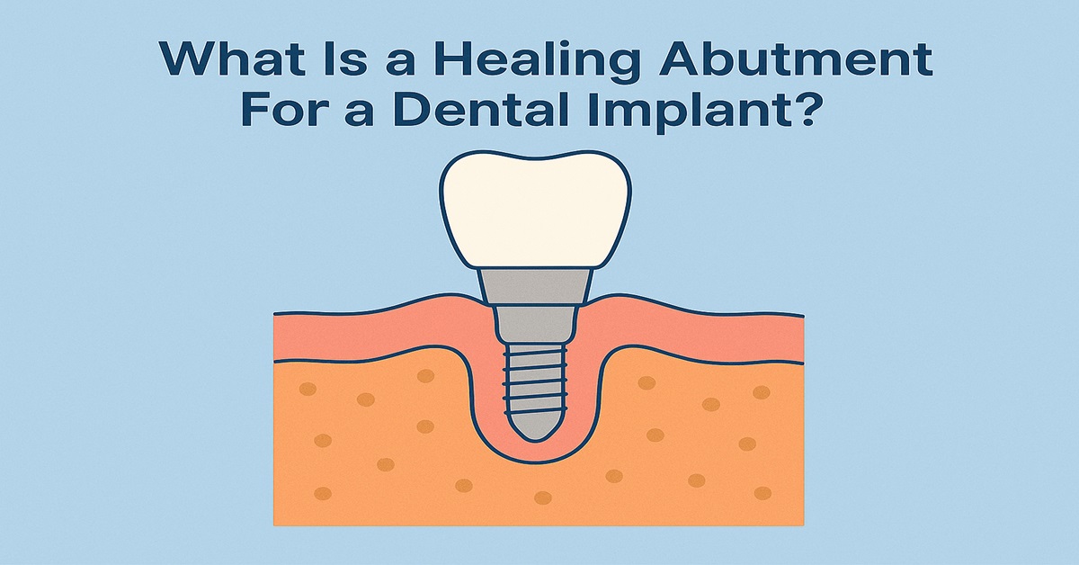 What Is a Healing Abutment For a Dental Implant?