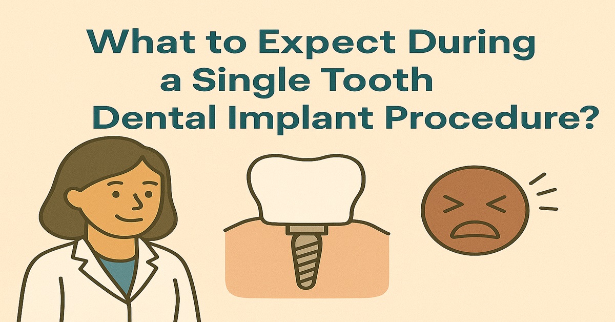 What to Expect During a Single Tooth Dental Implant Procedure