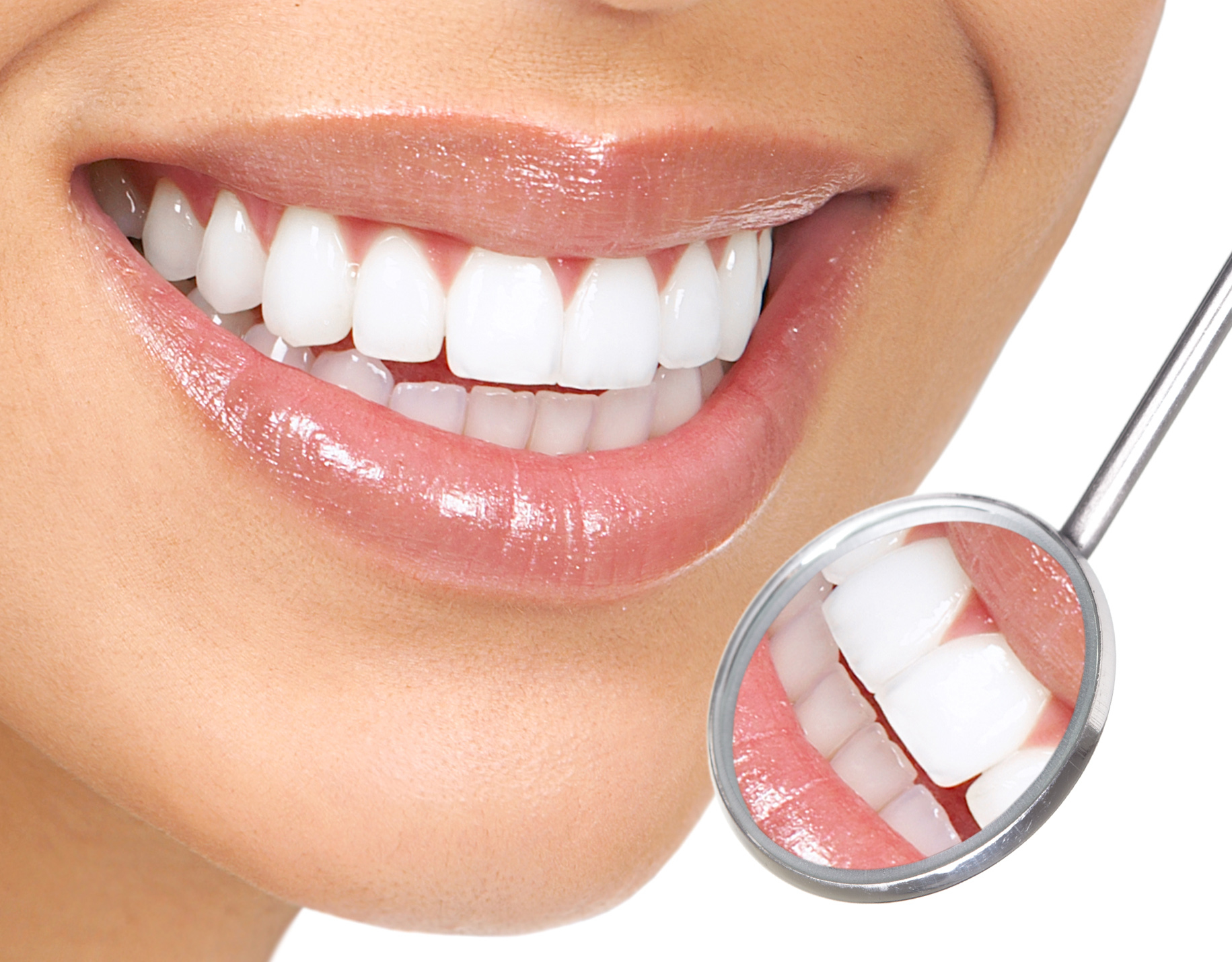 A Brighter Smile Awaits: Comprehensive Guide to Teeth Whitening in Tampa, FL